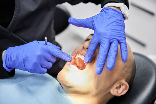 Best Emergency Dental Care for Abscessed Tooth in Ivanhoe, CA